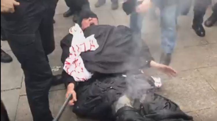 Мужчина поджег себя под Офисом президента из-за проблем с землей. Скриншот: Telegram/ Политика Страны