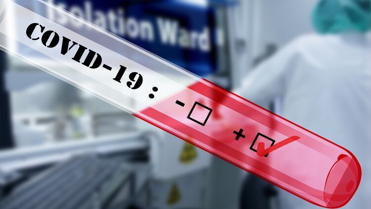 Стало известно еще одно последствие коронавирусной инфекции для человека. Фото: pixabay